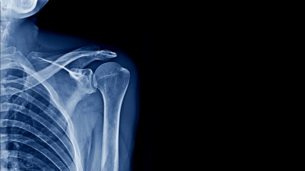 TÜV Rheinland Italia rilascia a Bonebridge il certificato CE